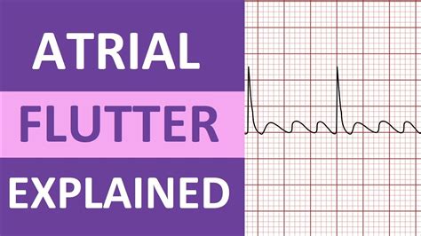 flutter vs flatter|Flattered vs Fluttered .